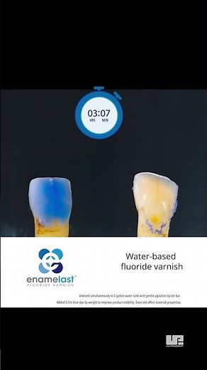 But does your fluoride varnish have adhesion like this?