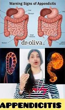 Warning Signs of Appendicitis #shorts #shortsfeed #appendicitis
