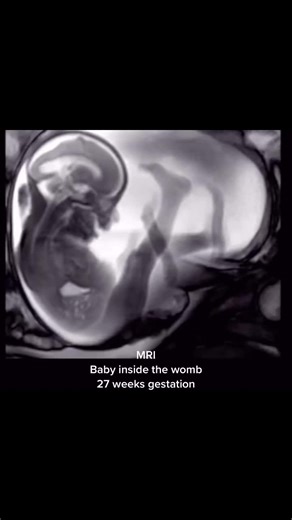 The sound just went with it 😅🙈 #pregnant #havingababy #ultrasound #viral #mri #mribaby #scary #scarytiktoks