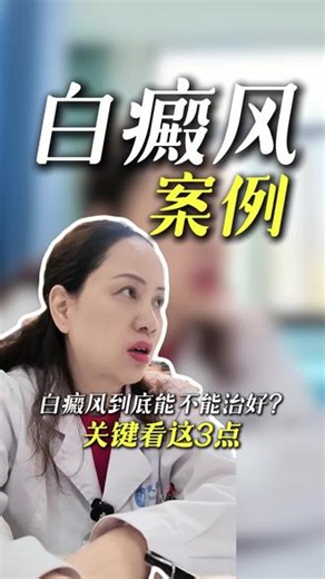 白癜风到底能不能治好 关键看这三点#白癜风 #白癜风科普 #武汉 #武汉邓红梅