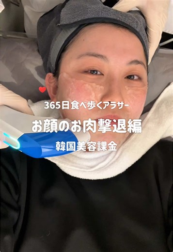 韓国美容施術レビュー：オーシャンクリニック体験