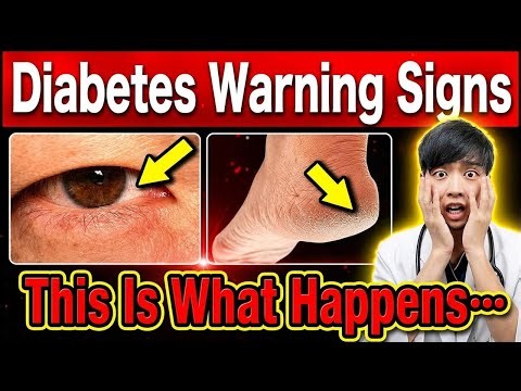 7 Early Warning Signs of Hidden Diabetes—Doctor Explains How to Spot Them Yourself