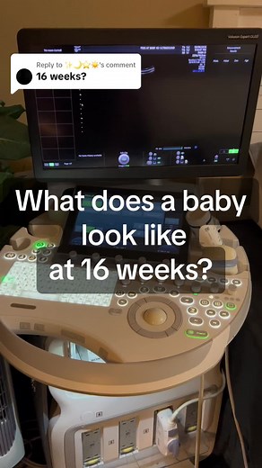 Replying to @✨🌙⭐️☀️ 16 weeks 🫶🏻 #fyp #baby #ultrasound #sonogram #4d #4dultrasound #peekatbaby #sonographer #pregnant #foryou #pregnancyjourney #ultrasoundtech #momtobe #momtok #momsoftiktok #2023momtobe #boy #girl #babyboy #babygirl #genderreveal #mom #momtobe2024 #duein2024 #16weekspregnant #16weeks