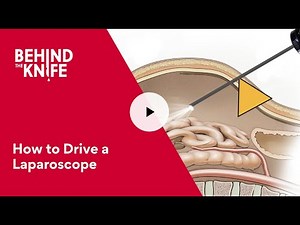 Behind the Knife - How to Drive a Laparoscope