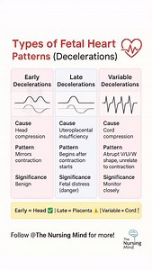 3.3K views · 160 reactions | 變Fetal Heart Rate Decelerations – Key...