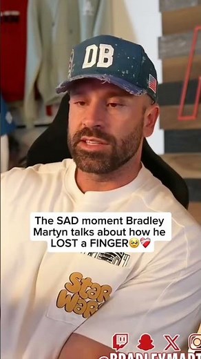 Bradley Martyn Explains How He Lost a Finger 😳🖐️t