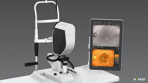 A video introduction to navigated retinal laser therapy with Navilas 577s - Eyetube