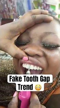 Fake Tooth Gap Trend #shorts #toothbanding #tiktoktrend