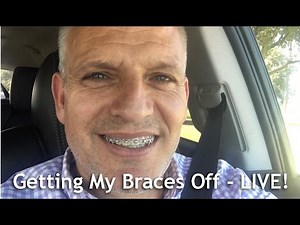 Getting Braces Off LIVE - Apple Orthodontix CEO Chad Packard Gets His Braces Removed