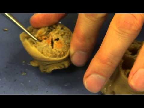 Sea Anemone Dissection