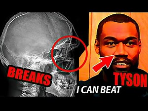Mike Tyson - BREAKS NOSE (Mike Tyson vs Jesse Ferguson) HD 1986