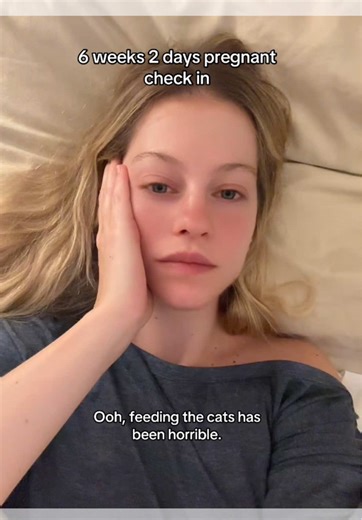 (delayed) spoiler alert: it did get worse 😭 I am now 10 weeks and posting these just now. I didn’t film any more updates in between this video and now as things have been really hard, physically and mentally. Talk about first trimester hell… I will update soon and open up about it a bit ❤️ #pregnancytiktok #pregnancysymptoms #firsttrimester #firsttrimestersymptoms #pregnancytok