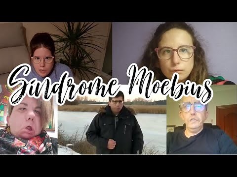 SÍNDROME DE MOEBIUS: La enfermedad sin sonrisa
