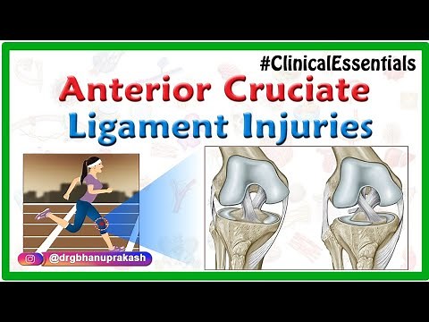 ACL Injuries / Anterior Cruciate Ligament Injuries Animation - Clinical essentials