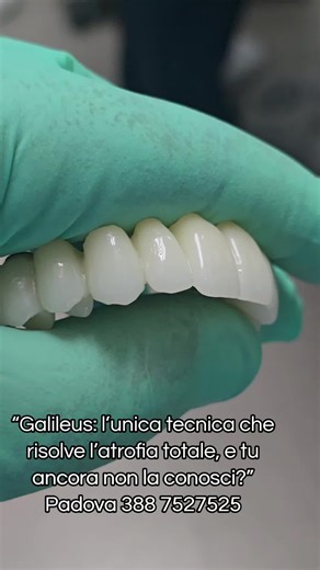 “Galileus: l’unica tecnica che risolve l’atrofia totale, e tu ancora non la conosci?” Padova 388 7527525