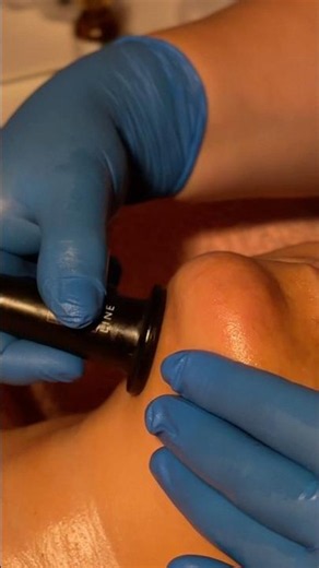 Have you ever noticed those small silicone cups used during a facial treatment?
