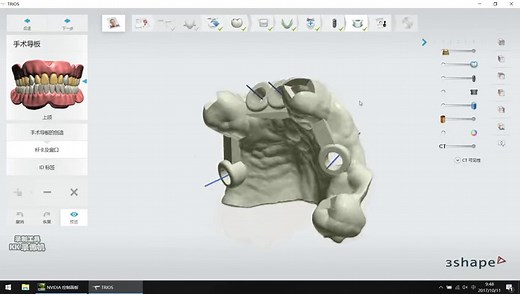 3shape软件操作视频3