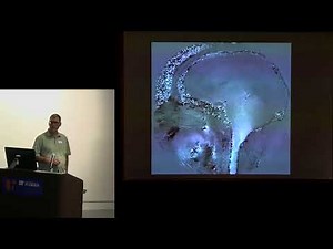 Importance of Resistance to CSF & Brain Tissue Motion in Chiari Symptomatology - Francis Loth, PhD