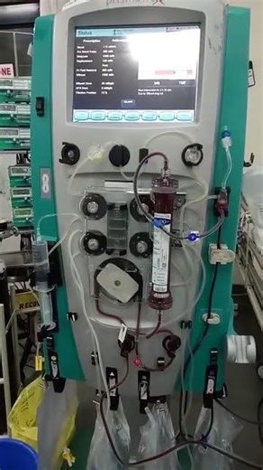 What is CRRT? dialysis #dialysis #shortvideo #crrtdialysis #hospital #hemodialysis #renaldialysis