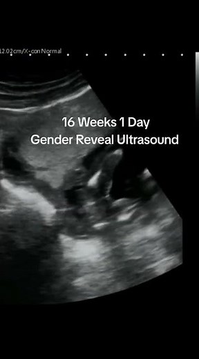 Girl Gender Reveal Ultrasound at 16 Weeks 1 Day Pregnant #genderrevealultrasound #girlfetus #fetus