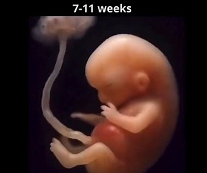 Human from conception. Human at every stage of development. | CitizenGO