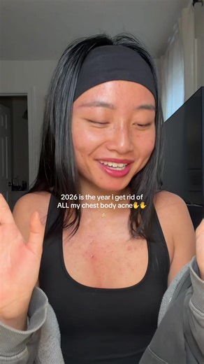 Overcoming Body Acne: My Journey to Clear Skin