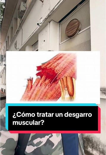 Cómo tratar un desgarro muscular de forma efectiva