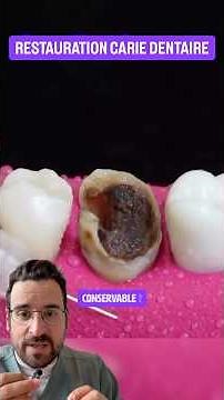 Tooth decay? How to treat it? Is it even possible?