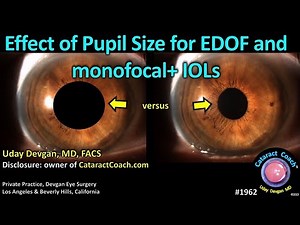CataractCoach™ 1962: effect of pupil size for EDOF IOLs (extended depth of focus)