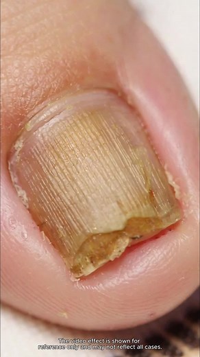 Transform Your Toenails with Creative Nail Ideas