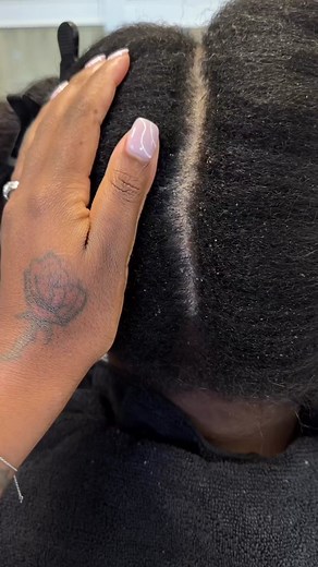 How to Maintain a Healthy Scalp without Clogging Pores