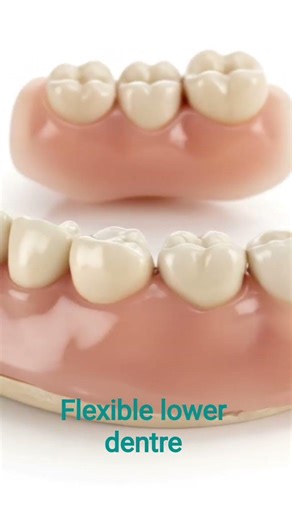 Flexible lower denture #dentist #dentalartistry #cosmeticdentistry #dentalclinic #shortvideo