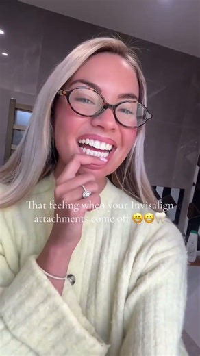 Invisalign transformation