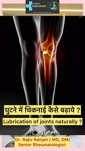 How to lubricate joints naturally? | घुटने की चिकनाई को कैसे बढ़ाये ? #arthritis #arthritisdoctor