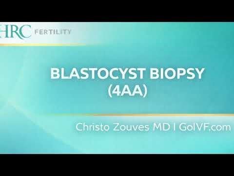 Blastocyst Biopsy 4AA HRC|FERTILITY