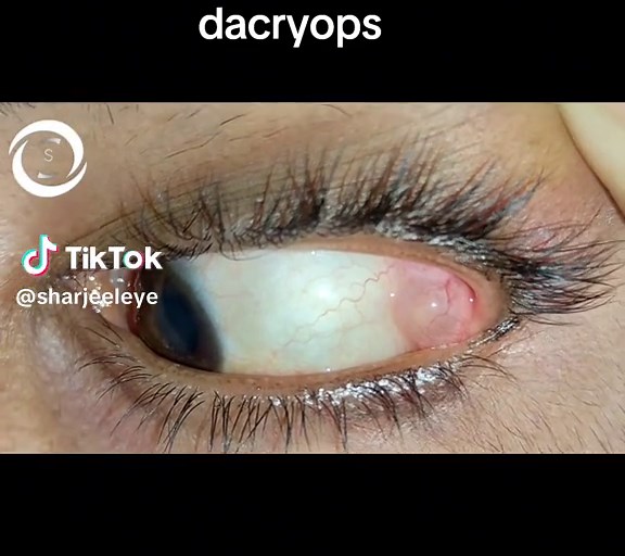 Sharjeel Eye on TikTok