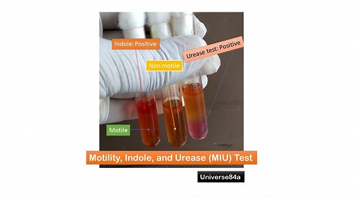 Motility, Indole, and Urease (MIU) Test: Uses, Principle, Composition, Proc