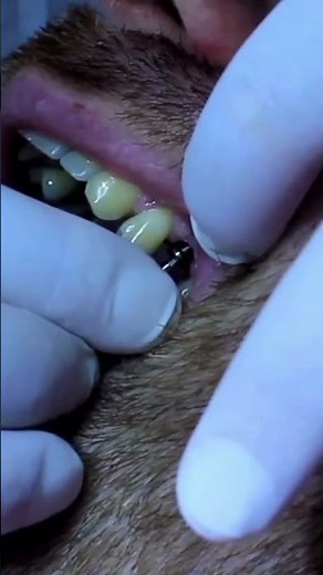 Root canal procedure step by step #dentalcare #rootcanal #dentist #teethwhitening #oralhygiene