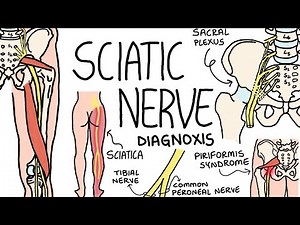 Understanding the anatomy of the sciatic nerve