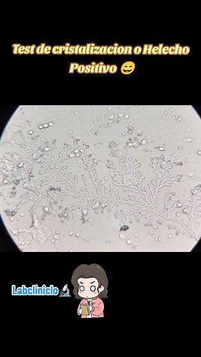 Test de cristalización o Helecho positivo 🔬🤓😉 #laboratorioclínico #🔬 #😉 #parati #videoviral