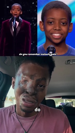 Malakai Bayoh was the teenage opera sensation who stunned Britain' s Got Talent with a once-in-a-generation voice while facing the pressure of becoming a classical music star before adulthood. Let's look back at his rise, his journey, and everything that followed. #MalakaiBayoh #BritainsGotTalent #OperaSinger #AGT #TalentShow