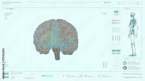 Health diagnostic computer system is used at the modern hospital. Health diagnostic computer analyzes the patients organs. Health diagnostic computer detects a dangerous growth in the brain. Cancer.