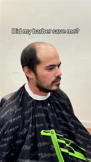 Hair systems give you instant results — no waiting months or risking side effects. No pills. No surgery. No “hope it works.” A men’s hair system gives you full, natural-looking hair the same day you decide to change it. ✔ Immediate transformation ✔ No medical risks or downtime ✔ Natural hairline, real movement ✔ Flexible, non-surgical solution This isn’t about chasing hair growth — it’s about getting control back. 🛒 Shop at Superhairpieces — link in bio 💬 Message us to book your consultation t