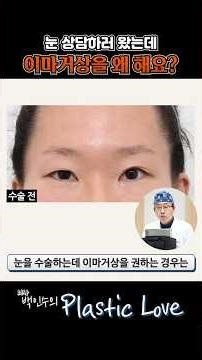 전후 차이 뭐야... 쌍수+이마거상 조합 미쳤는데? #shorts