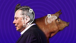 Elon Musk’s Neuralink: what’s science and what’s not | Verge Science