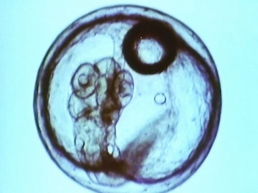 Embryonic development of medaka fish examined | Britannica