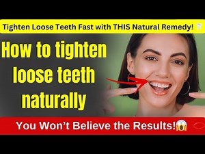 How to tighten loose teeth naturally | Loose tooth treatment home remedy | Strengthen loose teeth