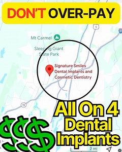 438 reactions · 36 shares | Lowest Price Implants & Highest Quality In Connecticut - Signature Smiles ✅ Embrace A Smile That You Never Have to Remove ✅ Fixed Implant Teeth Right After Surgery! ✅ Preserve Your Jawbone's Health and Youthful Appearance ✅ Farewell to Cavities and the Inconvenience of Dentures Our available appointments are filling up for the month. ⏳ | Signature Smiles Dental Implant Center | Facebook