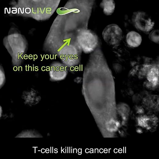 Label-free Live Cell Imaging: T-cells killing cancer cells