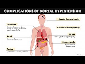 Portal Hypertensive Gastropathy ; Definition, causes, symptoms, Diagnosis, Treatment, Complications